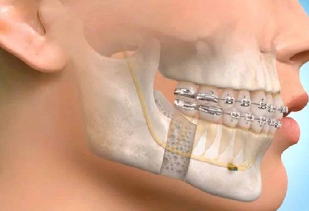 Facial Trauma Management | Garg Dental Clinic Sonipat | Dental Clinic in Sonipat
