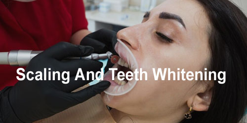 Treatments at Garg Dental Care &amp;amp; Implant Center | Dental Clinic in Sonipat