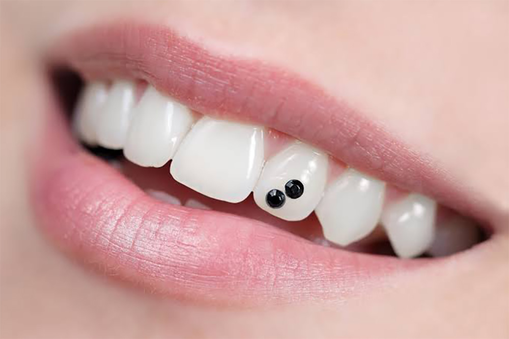 Tooth Jewelry | Garg Dental Care & Implant Center | Dental Clinic in Sonipat